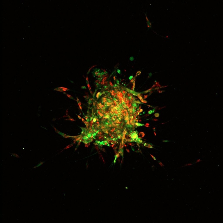 Lam fibroblast